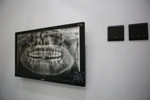 IMG 0873
