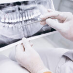 x ray teeth