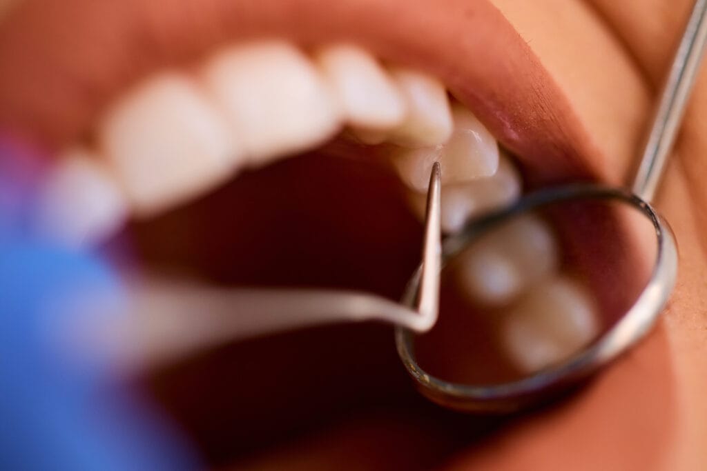 close up of woman having teeth examination at dent 2026 03 16 02 28 02 utc