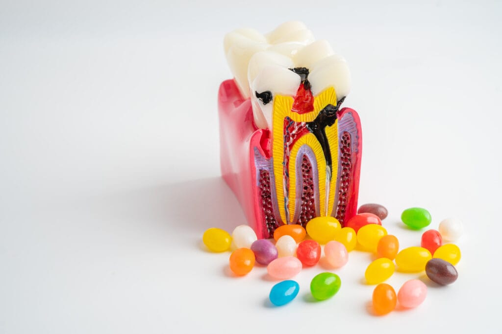 tooth decay model with colorful candy on white 2026 03 24 12 35 40 utc