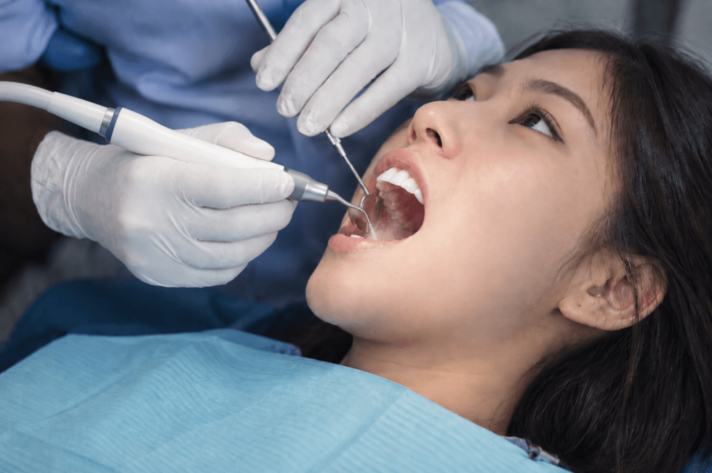 洗牙及牙齒拋光 1 JLDC tooth washing